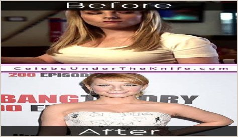 Melissa Rauch Plastic Surgery Before and After