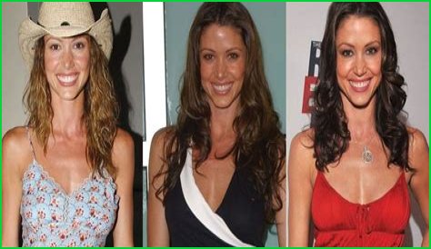 Shannon Elizabeth Plastic Surgery Before and After